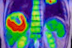 2011 11 29 10 13 53 429 Liver Tumor Philips Pet Mri Thumb