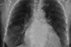 2011 12 07 12 02 30 339 2011 11 29 Digital Tomo Xray Thumb