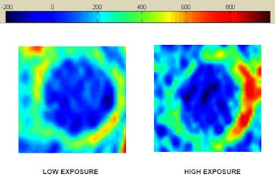 Dynamic Contrast Enhanced Mr Images Of Left Common Carotid Arteries