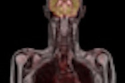 2011 12 12 11 49 21 346 Biograph M Mr Whole Body Thumb