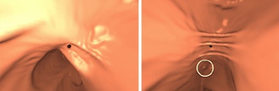 Prone Supine Registration Example