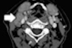 2012 01 19 16 24 45 255 Figure1mattednodes Thumb