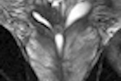2012 01 23 17 03 41 314 Preop Prostate Mri Thumb