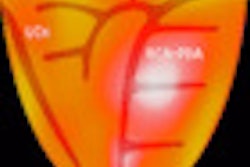 2012 02 01 15 11 49 98 Positron Thumb2