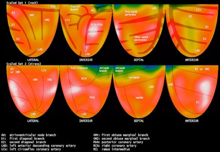 Positron seeks to bolster cardiac PET's rubidium-82 supply | AuntMinnie