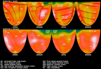 Pet Image Demonstrates A Mercator Projection Of Rest And Stress Images