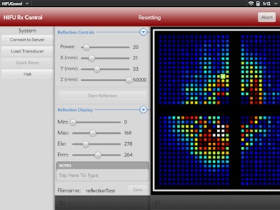 This App Allows For Control Of A Hifu Transducer