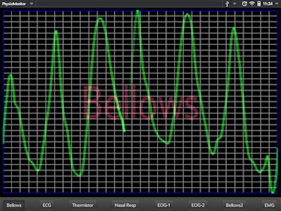 Physiological Monitoring App Currently Being Used In Sleep Mri Studies