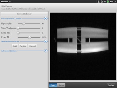 Touch Pad App Provides Real Time Control Of The Mri Scanner