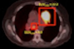 2012 02 02 16 21 38 469 Nsclc Scans Jnm Thumb