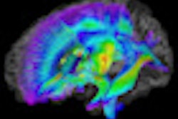 2012 02 16 16 27 39 943 Wolff Ajp Autism Image Thumb