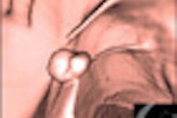 2012 02 22 16 10 46 121 Johnson thumb 02 Comp