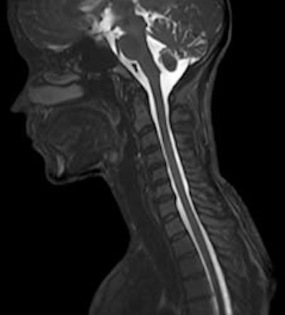 Magnetom Spectra is designed primarily for musculoskeletal and spine imaging.
