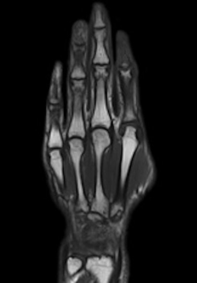 Magnetom Spectra hand image