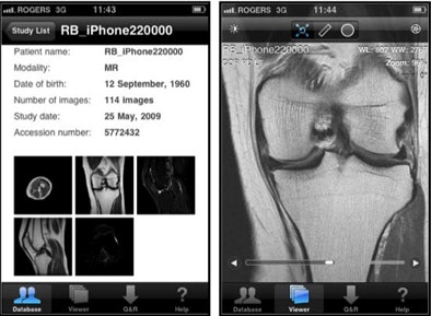 All Handheld Mobile Device Images Were Reviewed Using Osiri X Dicom Viewer Software Version 11 4 On An Apple I Phone 3 Gs Device
