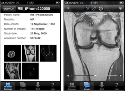 iPhone shows high accuracy for knee MRI AuntMinnie
