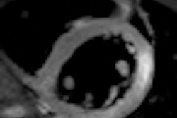 2012 02 27 15 02 18 527 2012 03 01 Cardiac Mri Thumb