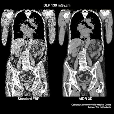 2012 02 27 15 24 43 676 Toshiba Ct 394