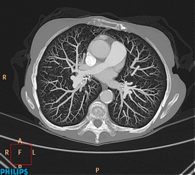 2012 02 27 15 24 46 539 Philips Ct 394