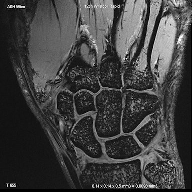 2012 02 28 15 35 34 772 P10 Saturday Rc1113 Ecr Fig3 394