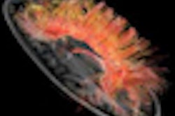 2012 02 28 16 57 27 852 Discovery Mr750w 3 0 T Neuro Dti Clinical Thumb