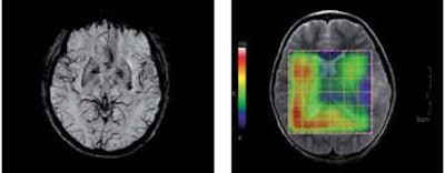 2012 02 28 16 57 32 208 Bsi Csi 450