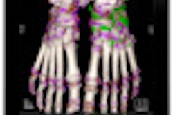 2012 02 28 18 57 53 734 02 Syngovia Webviewer Gout Thumb