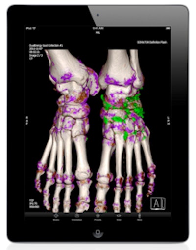 Image of patient with gout is displayed with syngo.via WebViewer. (Provided by Siemens)