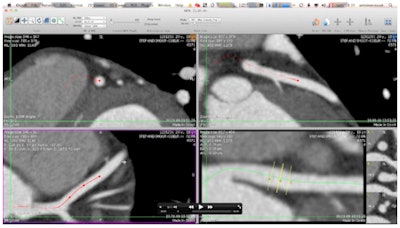 2012 02 29 14 36 42 126 Screen Shot2012 01 16at15 56 450