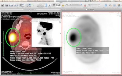 2012 02 29 14 36 45 609 Petct 02 450