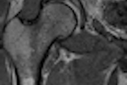 2012 03 06 15 55 43 140 Register Labral Tear Thumb