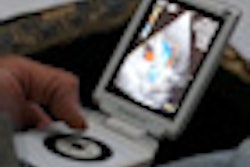 2012 03 08 15 40 07 173 Ase India Vscan Thumb