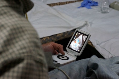 A Handheld Echocardiography System Shows Color Doppler Cardiac Blood Flow