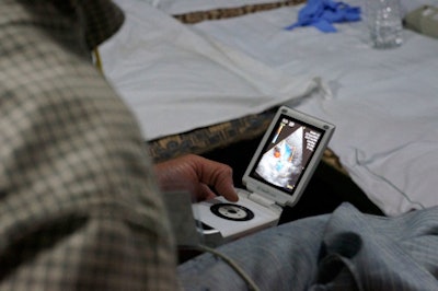 A Handheld Echocardiography System Shows Color Doppler Cardiac Blood Flow