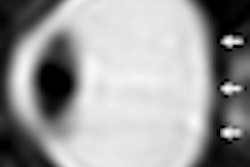 2012 03 12 15 56 05 238 Kramer Rad Astronaut Eyes Thumb