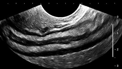 2012 03 15 13 40 15 119 Birnholz7 394