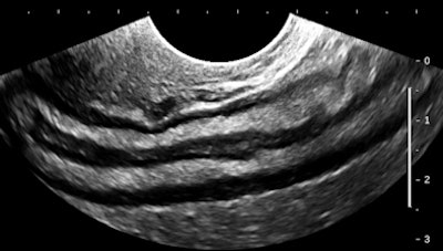 2012 03 15 13 40 15 119 Birnholz7 394