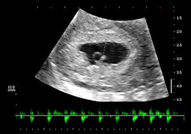 2012 03 15 13 40 17 19 Birnholz6 394