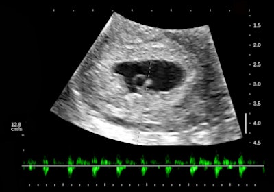 2012 03 15 13 40 17 19 Birnholz6 394