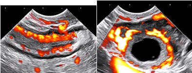 2012 03 15 13 40 18 90 Birnholz4and5 394