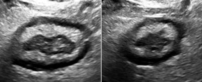 2012 03 15 13 40 20 181 Birnholz2and3 394