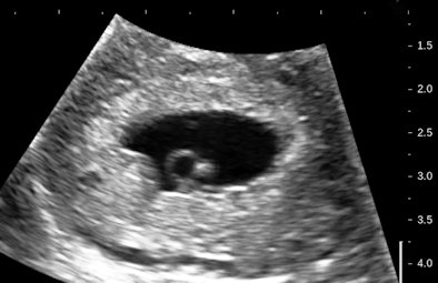 2012 03 15 13 40 21 165 Birnholz1 394