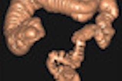 2012 03 30 13 35 51 258 Rizzati thumb 04 Comp