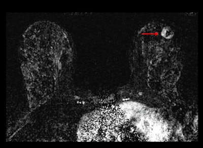 contrast-enhanced MRI