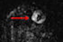 2012 04 03 13 25 56 482 Berg Mammo Thumb