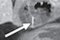 2012 04 05 07 08 09 198 Grand Abdominal Ct A 70