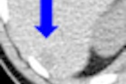 2012 04 05 17 00 29 865 Petct Image 01 70