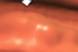 2012 04 13 11 25 38 513 Nappi Thumb 70