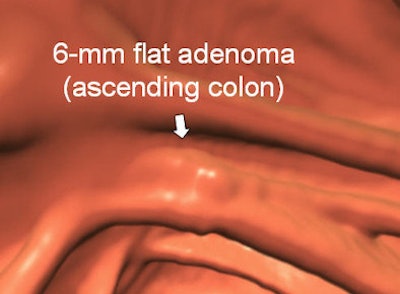 2012 04 13 11 41 15 47 Nappi flat detected top V2 394