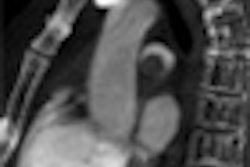 2012 04 18 08 59 56 663 Zamboni thumb 04 Comp